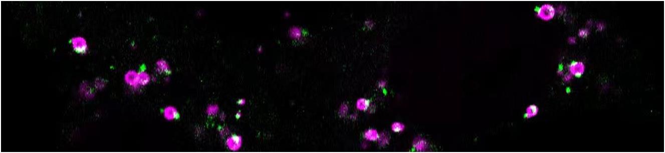 Journal of Cell Biology|杨崇林实验室揭示依赖于逆向蛋白运输复合体Retromer胞内运输的调控机制